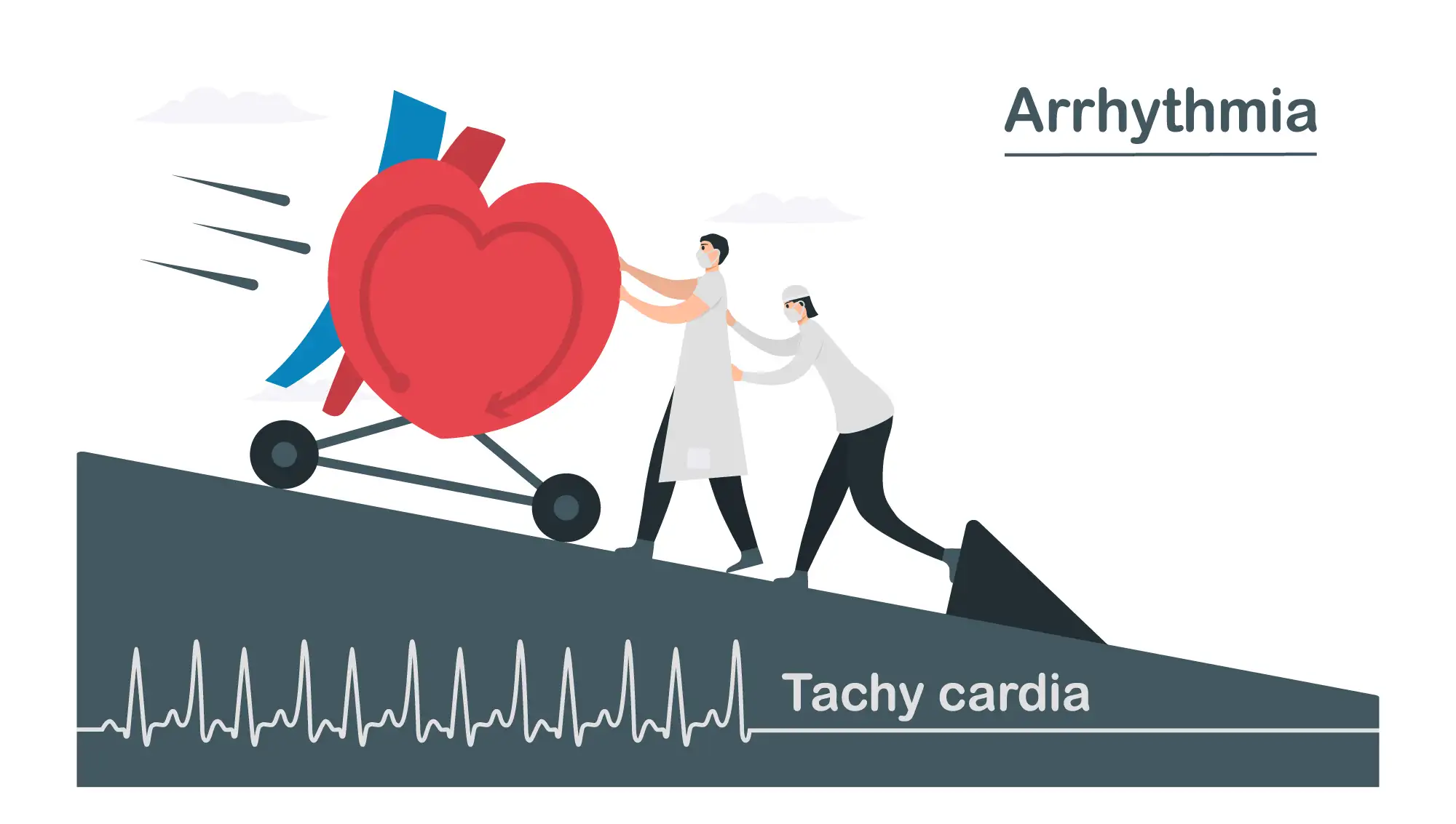 Fig-4-tachycardia-[Converted]